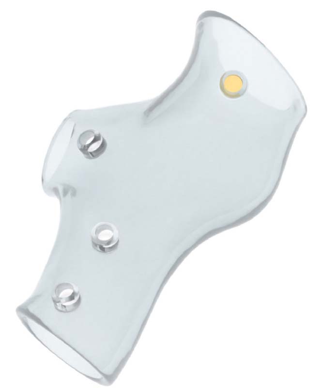 NOVATECH® 3D Stent NOVATECH® 3D Stent